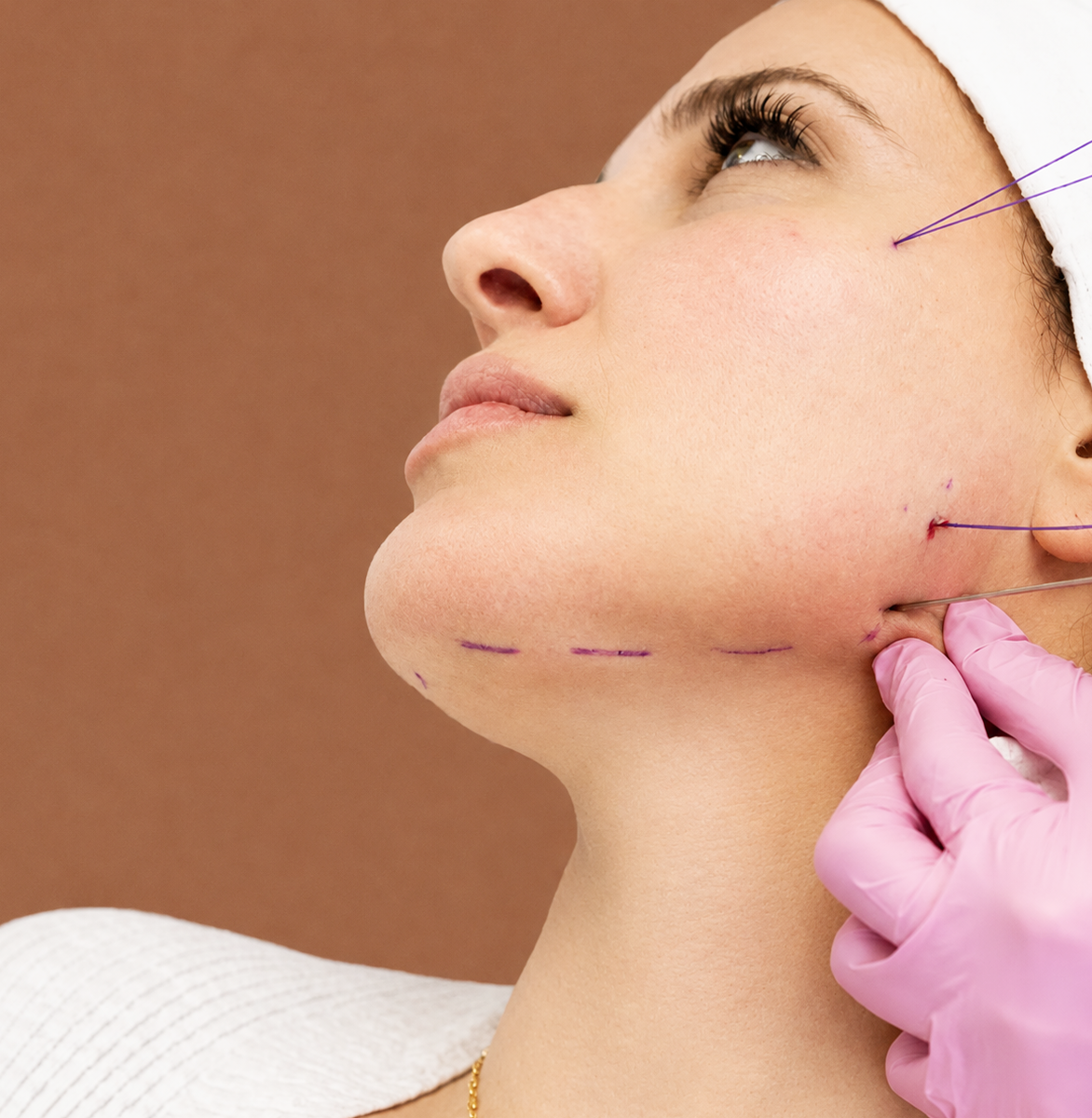 Management Tips for Advanced Manual Facial Treatment?.