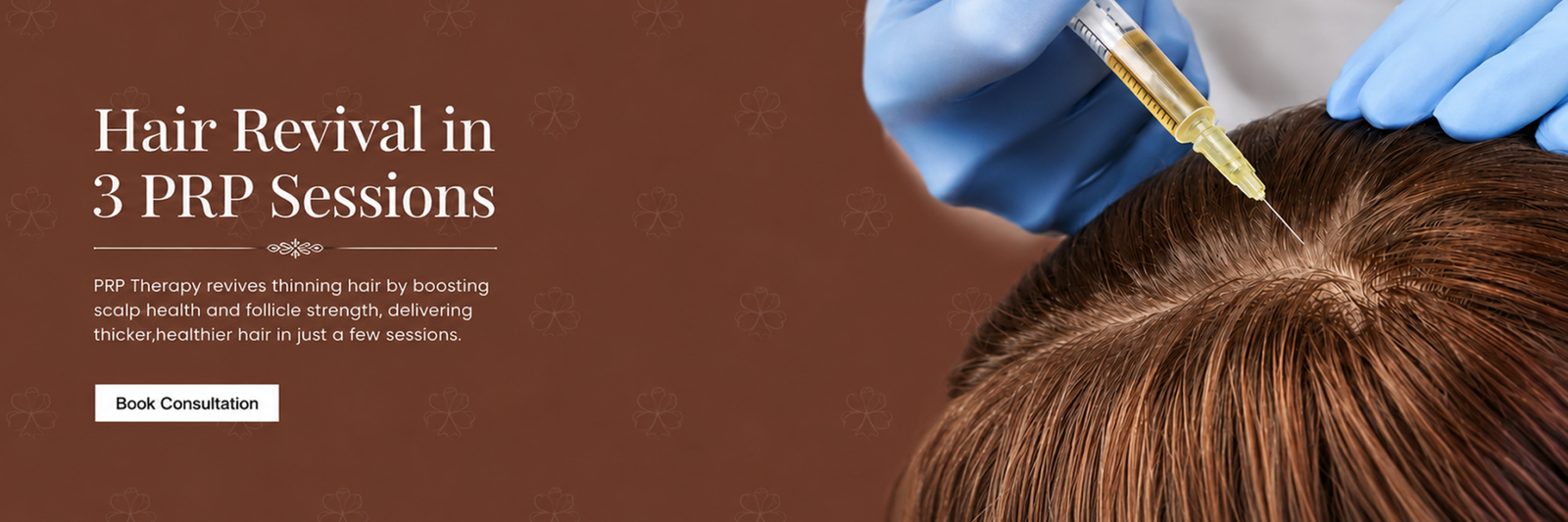 PRP Treatment