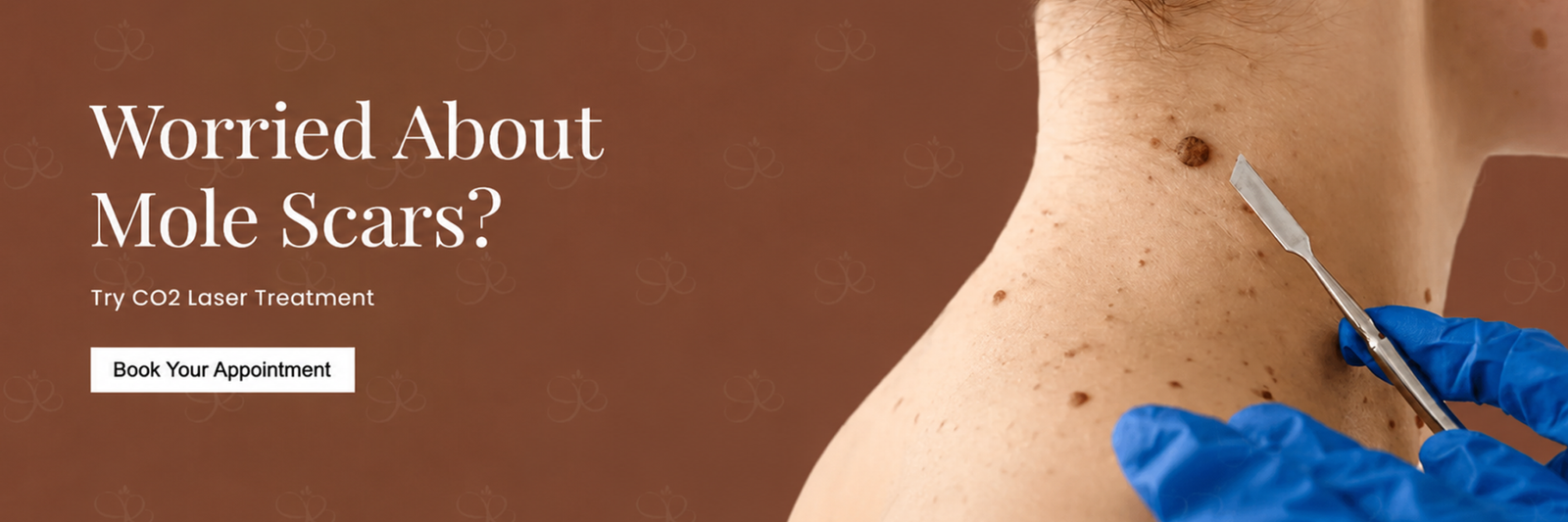 Tattoo Removal / Mole Removal Treatment